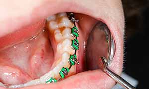 periodontics in etobicoke dentist