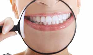 teeth whitening in etobicoke dentist