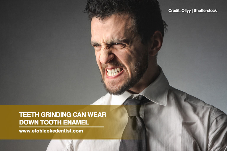Teeth grinding can wear down tooth enamel