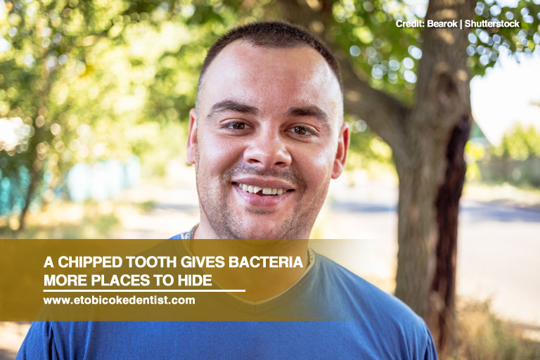 A chipped tooth gives bacteria more places to hide