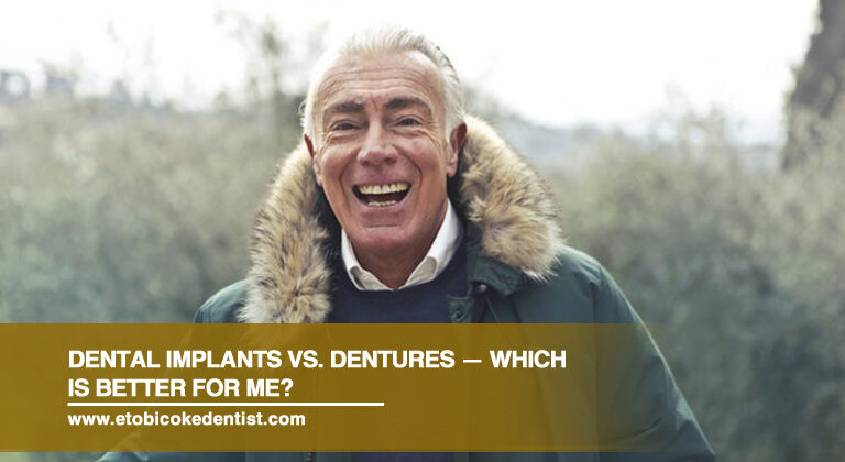 Dental Implants vs. Dentures — Which Is Better for Me?