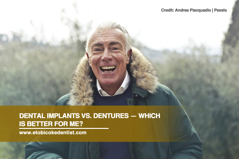 Dental Implants vs. Dentures — Which Is Better for Me?