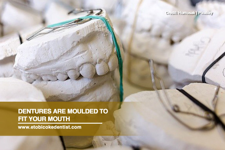 Dentures are moulded to fit your mouth