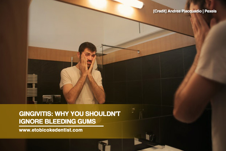 Gingivitis: Why You Shouldn’t Ignore Bleeding Gums