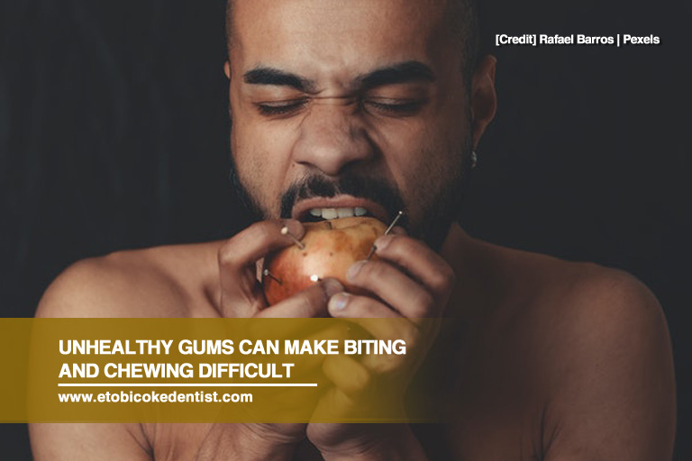 Unhealthy gums can make biting and chewing difficult