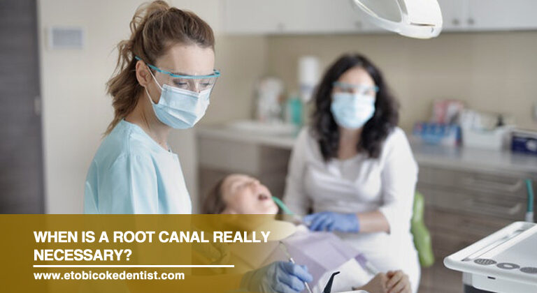 When Is a Root Canal Really Necessary?