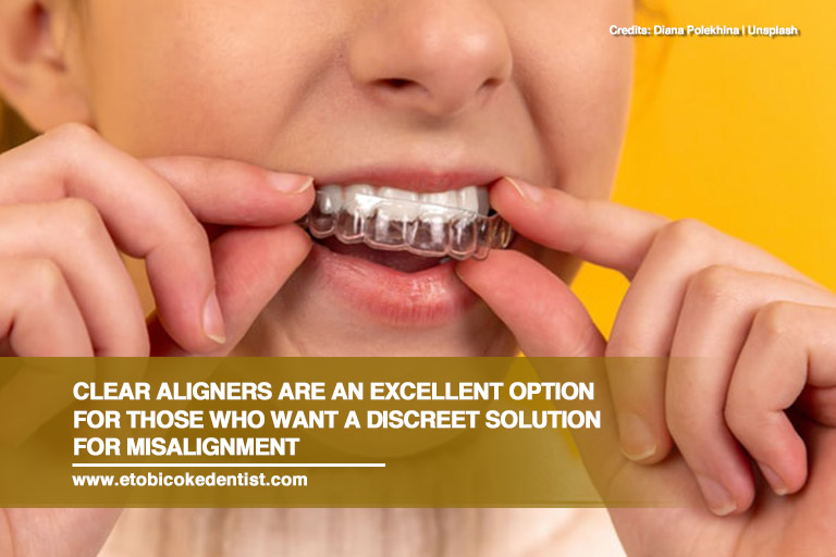 Clear aligners are an excellent option for those who want a discreet solution for misalignment
