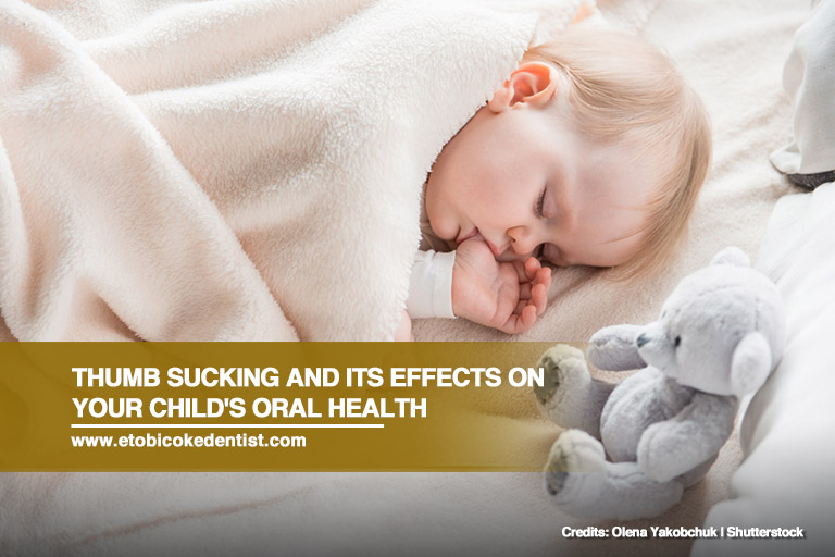 Thumb Sucking and Its Effects on Your Child’s Oral Health