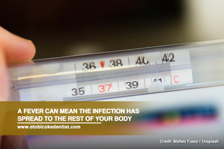 A fever can mean the infection has spread to the rest of your body