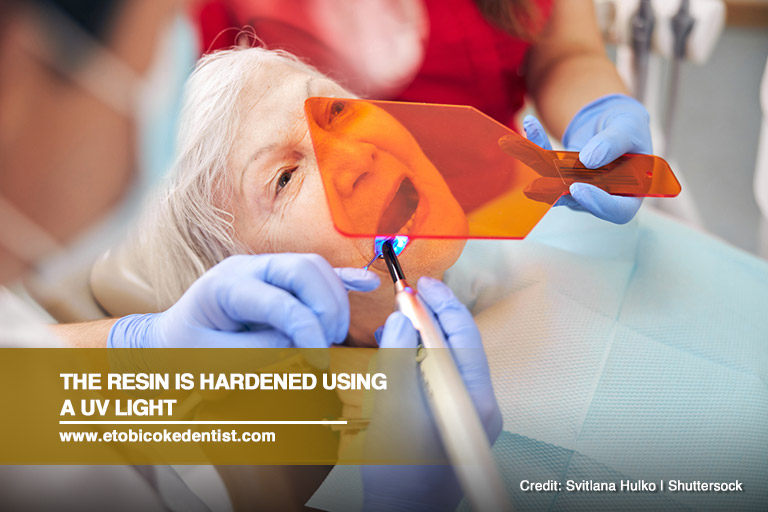 The-resin-is-hardened-using-a-UV-light