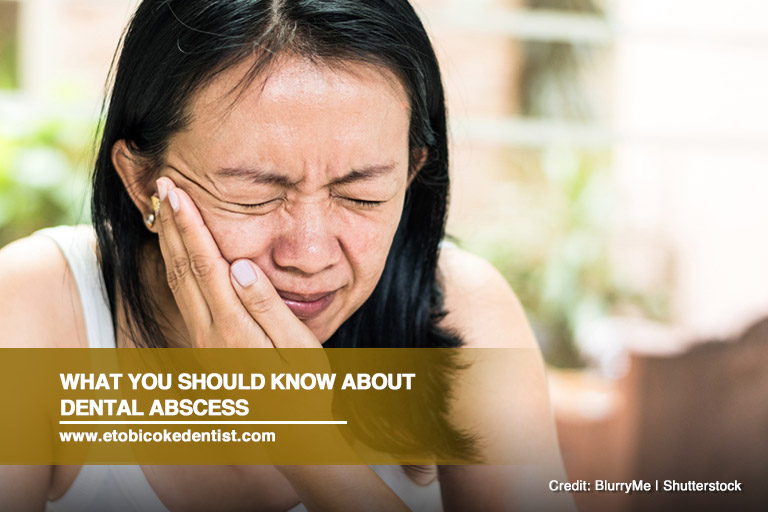 What You Should Know About Dental Abscess