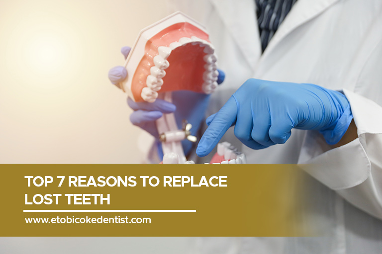 Top 7 Reasons to Replace Lost Teeth Dr. Mark Rhody Dentistry