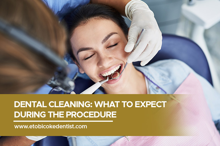 Dental Cleaning: What to Expect During the Procedure